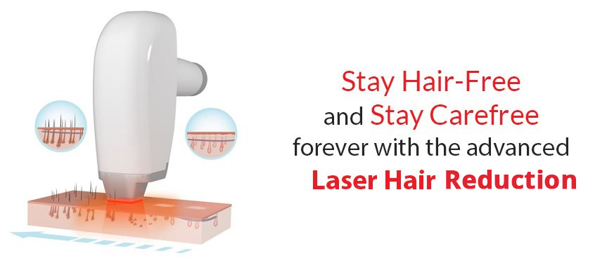 Laser Hair Removal Dubai